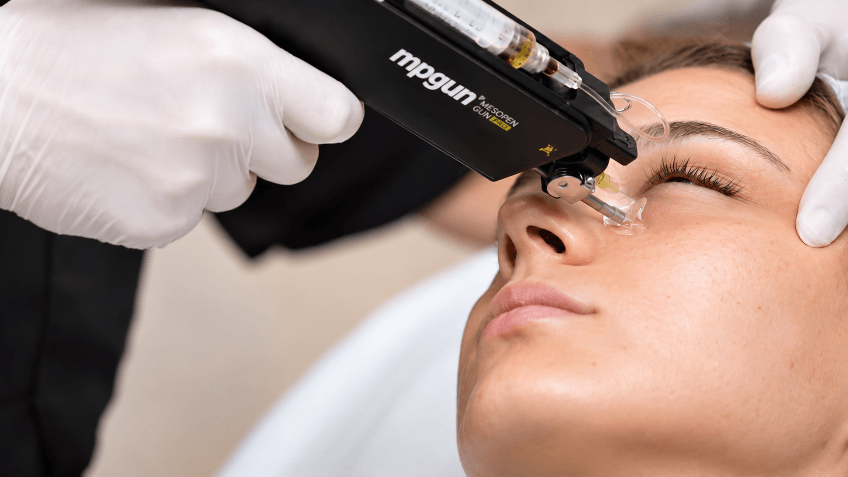 Mesotherapie prp huid