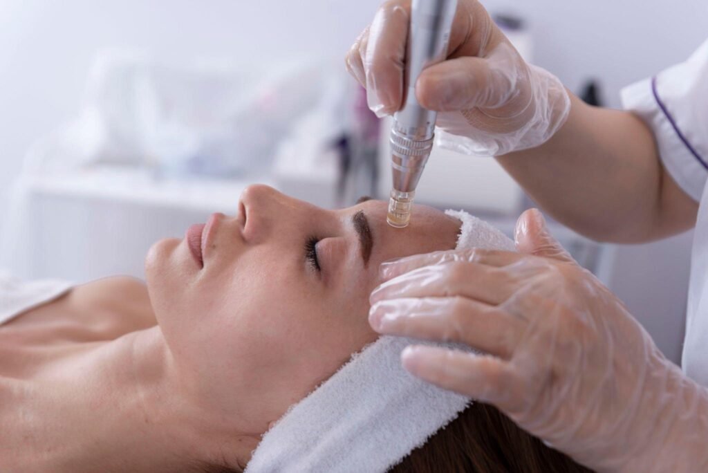 Microneedling (Dermapen4)