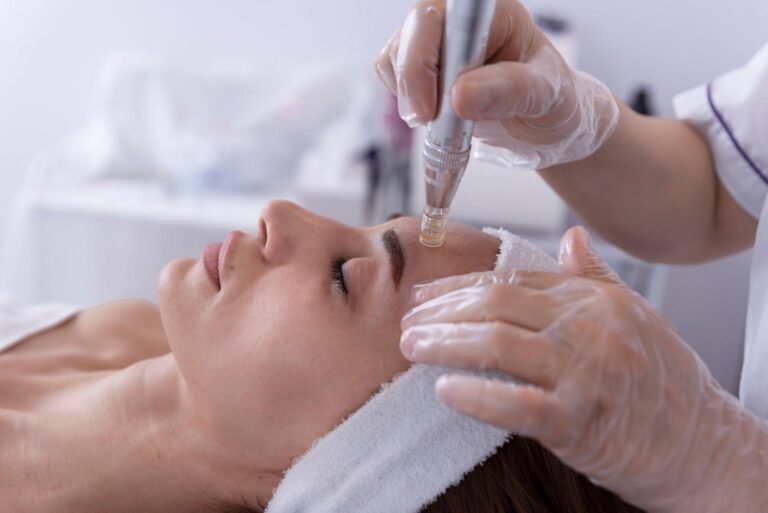 Microneedling (Dermapen4)