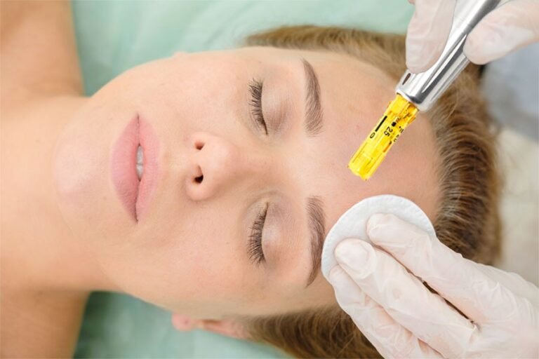 Microneedling Dermapen4