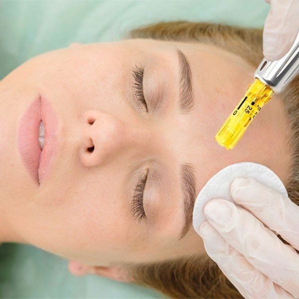 dermapen-microneedling-face-252788058.jpg